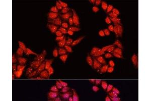 Immunofluorescence analysis of HeLa cells using ALDH9A1 Polyclonal Antibody at dilution of 1:100. (ALDH9A1 anticorps)