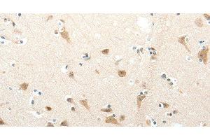 Immunohistochemistry of paraffin-embedded Human brain tissue using SEMA3D Polyclonal Antibody at dilution 1:50