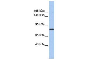 KLHL32 antibody used at 1 ug/ml to detect target protein. (KLHL32 anticorps)