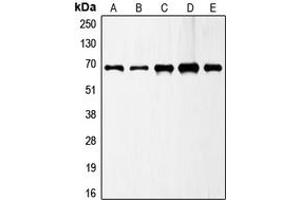 Western blot analysis of GAD1 expression in A549 (A), MCF7 (B), SP2/0 (C), PC12 (D), SKNSH (E) whole cell lysates.