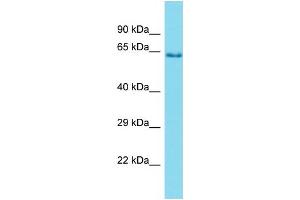 Western Blotting (WB) image for anti-Protease, Serine, 56 (PRSS56) (C-Term) antibody (ABIN2791462) (PRSS56 anticorps  (C-Term))
