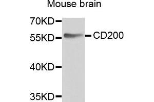 Western blot analysis of extracts of mouse brain, using CD200 antibody. (CD200 anticorps)