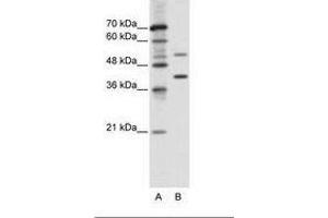Image no. 1 for anti-REX4, RNA Exonuclease 4 Homolog (REXO4) (AA 270-319) antibody (ABIN6736107) (REXO4 anticorps  (AA 270-319))