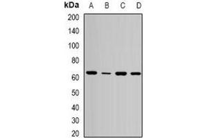 Western blot analysis of SPE39 expression in MCF7 (A), HepG2 (B), mouse liver (C), mouse kidney (D) whole cell lysates. (VIPAR anticorps)