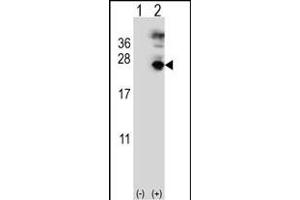 Western blot analysis of MF (arrow) using rabbit polyclonal MF Antibody (C-term) (ABIN391487 and ABIN2841455). (MFAP5 anticorps  (C-Term))
