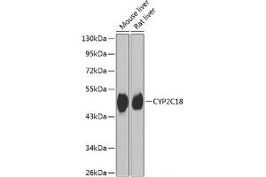 Western blot analysis of extracts of various cell lines using CYP2C18 Polyclonal Antibody at dilution of 1:1000.