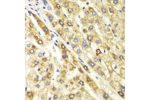 Immunohistochemistry (IHC) image for anti-C-terminal Binding Protein 1 (CTBP1) (AA 20-250) antibody (ABIN3022422) (CTBP1 anticorps  (AA 20-250))