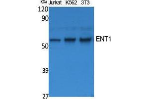 Western Blotting (WB) image for anti-Solute Carrier Family 29 (Nucleoside Transporters), Member 1 (SLC29A1) (N-Term) antibody (ABIN3187600) (SLC29A1 anticorps  (N-Term))