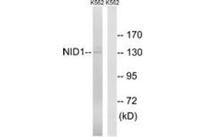 Western blot analysis of extracts from K562 cells, using NID1 Antibody.