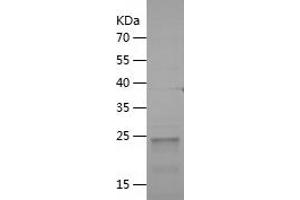Western Blotting (WB) image for Coilin (COIL) (AA 1-203) protein (His tag) (ABIN7122436)