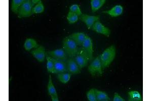 Immunofluorescence staining of Hela cells with ABIN7139823 at 1:166, counter-stained with DAPI. (EIF4G3 anticorps  (AA 158-176))