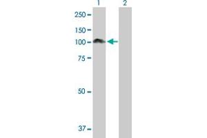 Western Blot analysis of PDCD6IP expression in transfected 293T cell line by PDCD6IP MaxPab polyclonal antibody. (ALIX anticorps  (AA 1-868))