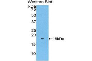 Western Blotting (WB) image for anti-Periostin (POSTN) (AA 24-173) antibody (ABIN1176623) (Periostin anticorps  (AA 24-173))