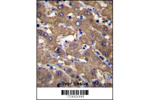 UGDH Antibody immunohistochemistry analysis in formalin fixed and paraffin embedded human liver tissue followed by peroxidase conjugation of the secondary antibody and DAB staining. (UGDH anticorps  (C-Term))