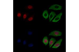 CASC5 Antibody staining Hela cells by IF/ICC. (CASC5 anticorps  (Internal Region))