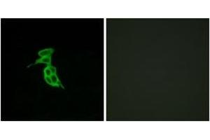 Immunofluorescence analysis of LOVO cells, using GPR143 Antibody. (GPR143 anticorps  (AA 151-200))