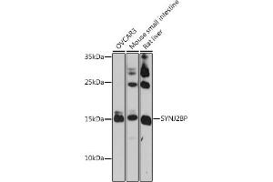 Western blot analysis of extracts of various cell lines, using SYNJ2BP antibody (ABIN7270667) at 1:1000 dilution. (SYNJ2BP anticorps  (AA 1-145))