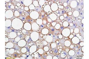 Formalin-fixed and paraffin embedded rat liver labeled with Anti-TIP47/M6PRBP1 Polyclonal Antibody, Unconjugated (ABIN681613) followed by conjugation to the secondary antibody and DAB staining (PLIN3 anticorps  (AA 351-434))