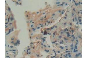 Detection of GBA in Human Lung Tissue using Polyclonal Antibody to Glucocerebrosidase (GBA) (GBA anticorps  (AA 117-214))