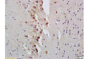 Formalin-fixed and paraffin embedded rat brain labeled with Rabbit Anti-STAT1 Polyclonal Antibody, Unconjugated  at 1:200 followed by conjugation to the secondary antibody and DAB staining