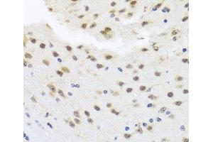 Immunohistochemistry of paraffin-embedded Mouse brain using HDAC4 Polyclonal Antibody at dilution of 1:100 (40x lens). (HDAC4 anticorps)