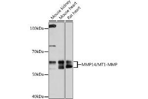 Western blot analysis of extracts of various cell lines, using MMP14/MMP14/MT1-MMP Rabbit mAb (ABIN7268420) at 1:1000 dilution. (MMP14 anticorps)