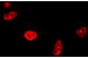 Immunofluorescent analysis of RAD17 staining in A549 cells. (RAD17 anticorps  (C-Term))