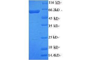 SDS-PAGE (SDS) image for Arylsulfatase B (ARSB) (AA 37-533) protein (His-SUMO Tag) (ABIN5709081)