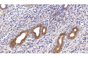 Detection of CK18 in Rat Uterus Tissue using Polyclonal Antibody to Cytokeratin 18 (CK18)