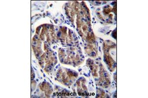 RPS4Y1 Antibody (Center) (ABIN656730 and ABIN2845954) immunohistochemistry analysis in formalin fixed and paraffin embedded human stomach tissue followed by peroxidase conjugation of the secondary antibody and DAB staining. (RPS4Y1 anticorps  (AA 76-105))