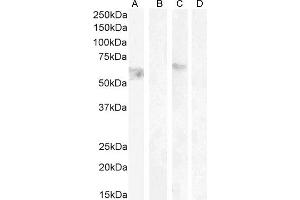 ABIN185484 (1 μg/mL) staining of HeLa lysate non-glycosylated (A) + peptide (B) and (0. (CNR1 anticorps  (Internal Region))