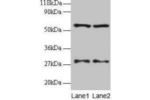 Western blot All lanes: SARS antibody at 2 μg/mL Lane 1: EC109 whole cell lysate Lane 2: 293T whole cell lysate Secondary Goat polyclonal to rabbit IgG at 1/15000 dilution Predicted band size: 59 kDa Observed band size: 59 kDa (Seryl-tRNA Synthetase (SARS) (AA 2-233) anticorps)