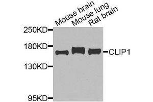 Western blot analysis of extracts of various cell lines, using CLIP1 antibody. (CLIP1 anticorps  (AA 1228-1427))