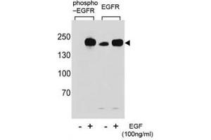 Western blot analysis of extracts from A431 cells,untreated or treated with EGF, using p-EGFR antibody (left) or nonphos Ab (right). (EGFR anticorps  (pTyr1069))