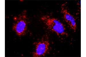 Proximity Ligation Analysis of protein-protein interactions between MAP3K7 and RUVBL1. (RUVBL1 anticorps  (AA 1-456))