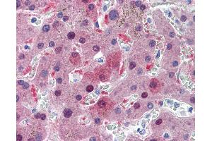 Anti-GSTA1 antibody IHC of human liver. (GSTA1 anticorps  (AA 1-222))