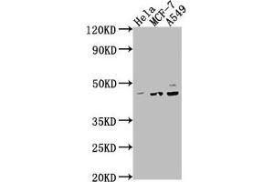 Western Blot Positive WB detected in: Hela whole cell lysate, MCF-7 whole cell lysate, A549 whole cell lysate All lanes: PRKACA antibody at 1:2000 Secondary Goat polyclonal to rabbit IgG at 1/50000 dilution Predicted band size: 41, 40 kDa Observed band size: 41 kDa (PRKACA anticorps  (Catalytic Subunit alpha))