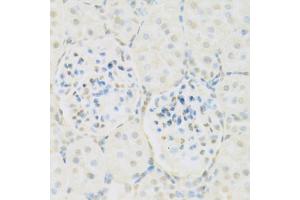 Immunohistochemistry of paraffin-embedded rat kidney using KAT2A antibody (ABIN5971244) at dilution of 1/100 (40x lens). (KAT2A anticorps)