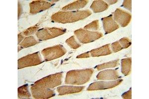 IHC analysis of FFPE human skeletal muscle stained with SMAD4 antibody