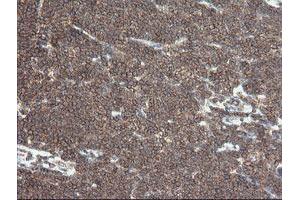 anti-Differentially Expressed in FDCP 6 Homolog (DEF6) antibody