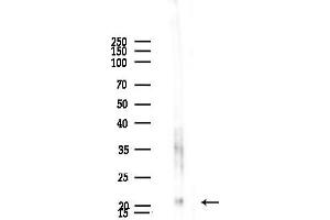 Western blot analysis of lysates from Hela cells(heat-shock,45 min treatment), using MRPL21 Antibody at 1/1000 dilution.