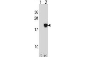 Western Blotting (WB) image for anti-Small Ubiquitin Related Modifier 4 (SUMO4) antibody (ABIN2996865) (SUMO4 anticorps)