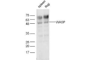 Lane 1: Mouse spleen lysates, Lane 2: Raji lysates, probed with Anti-WASP Polyclonal Antibody at 1:5000 90min in 37˚C. (WASP anticorps  (AA 101-200))