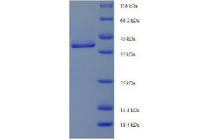 SDS-PAGE of protein expressed in E.
