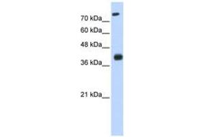 Image no. 1 for anti-ISL LIM Homeobox 2 (ISL2) (N-Term) antibody (ABIN6742917) (ISL2 anticorps  (N-Term))