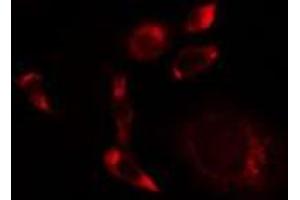 ABIN6275514 staining A549 cells by IF/ICC. (SCFD1 anticorps  (C-Term))