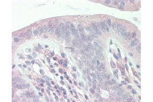 Anti-SLC9A1BP / CHP antibody IHC staining of human colon.