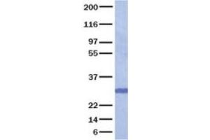 Validation with Western Blot