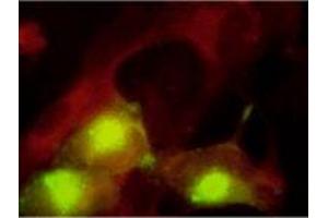 Immunofluorescence (IF) image for anti-Pp28 Tegument Protein (CMV Pp28) antibody (ABIN265539) (Pp28 Tegument Protein (CMV Pp28) anticorps)