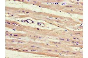 Immunohistochemistry of paraffin-embedded human heart tissue using ABIN7155128 at dilution of 1:100 (HNRPLL anticorps  (AA 1-72))